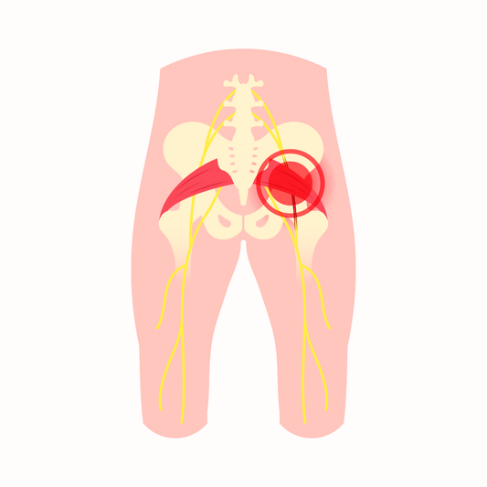 Pregnancy Related Pelvic Girdle Pain